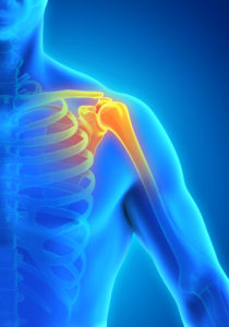 Dr. Sonal Kapoor Physiotherapy Clinic - Rotator Cuff Tear