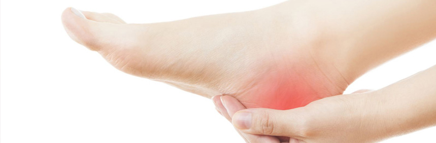 Bruised heel bone can be painful! Causes, Symptoms & Treatments
